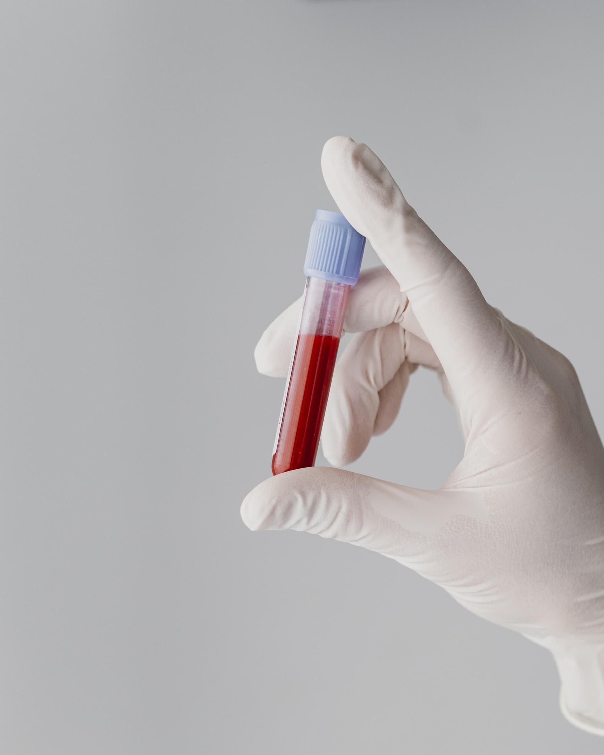 Dlaczego badania laboratoryjne są tak ważne?